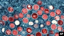 美国国家过敏及感染疾病研究院公布的猴痘（Monkeypox）病毒的彩色照片。-美联社资料照