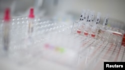 View of blood tests in a hospital (file photo)