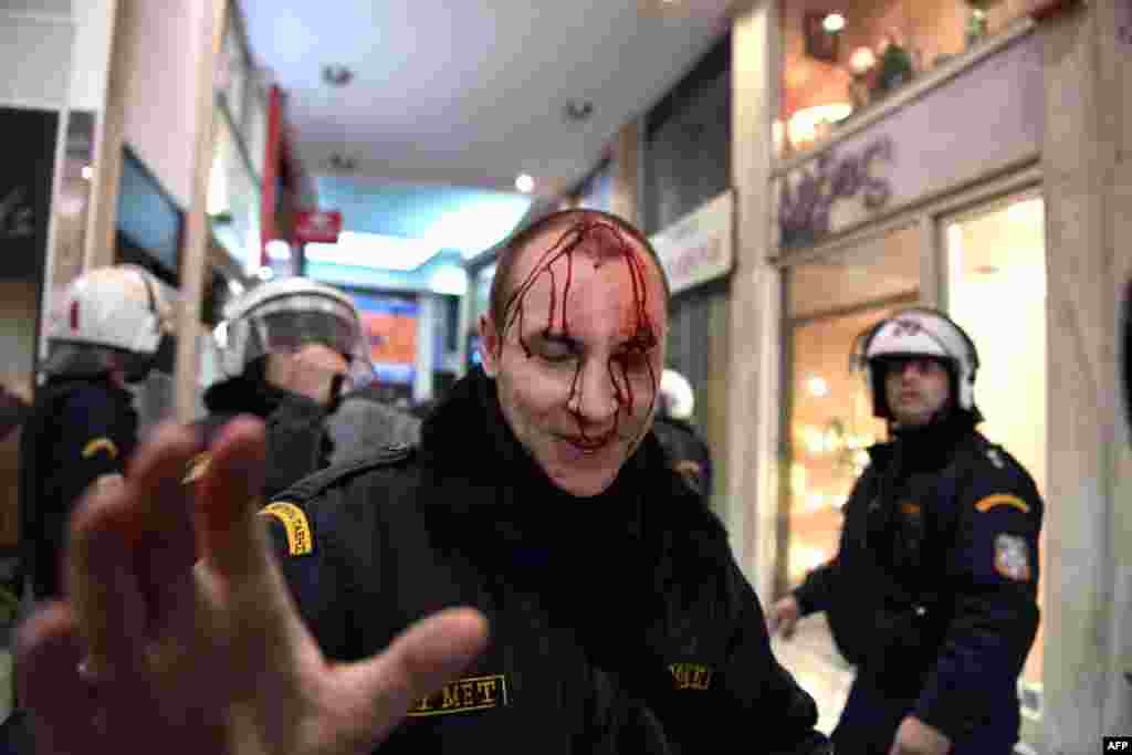 A riot policeman bleeds during clashes with demonstrators protesting against the government’s decision to amend the law on strikes, in Athens, Greece.