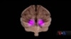 16x9 Image