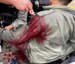 在香港主权移交中国纪念日当天港人游行反对港版国安法期间一名港警受伤。（2020年7月1日）
