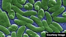 The Vibrio vulnificus is seen in this handout from the U.S. Centers for Disease Control and Prevention. 