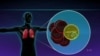 Gene Tests May Improve Lung Cancer Care